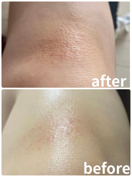 化粧水・敏感肌用・高保湿タイプ/無印良品/化粧水を使ったクチコミ(5枚目)