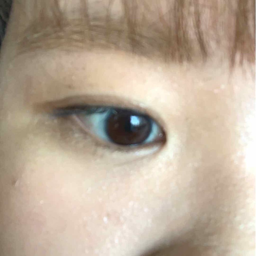 アクティブアイトークII/アイトーク/二重まぶた用アイテムを使ったクチコミ（3枚目）