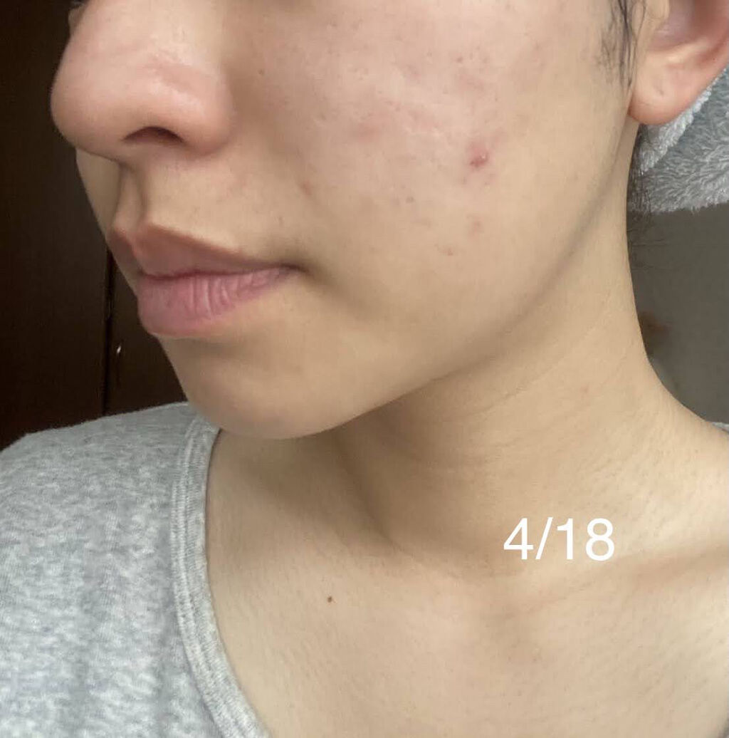 Napcaモイスチャーミスト/ニュースキン/ミスト状化粧水を使ったクチコミ（3枚目）