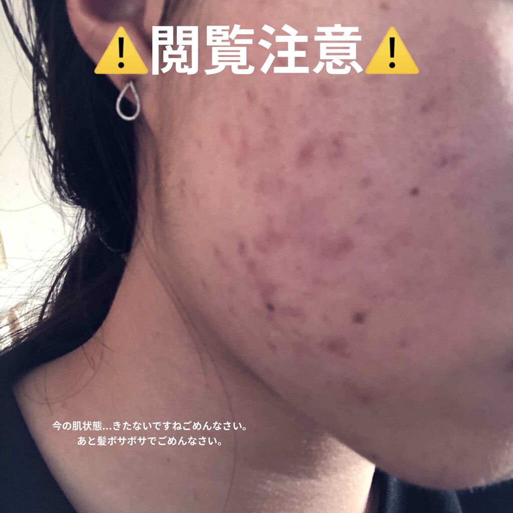 美白 うるおい ジェル/ちふれ/オールインワン化粧品を使ったクチコミ（3枚目）