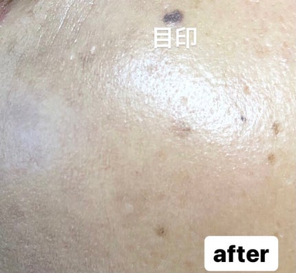 カラースティックコンシーラー/キャンメイク/スティックコンシーラーを使ったクチコミ(4枚目)