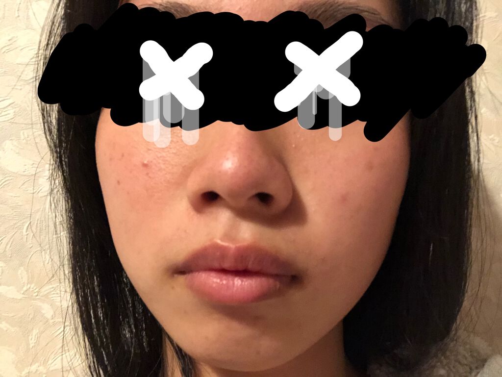 艶肌ドロップ/ラッシュ/美容液を使ったクチコミ(3枚目)