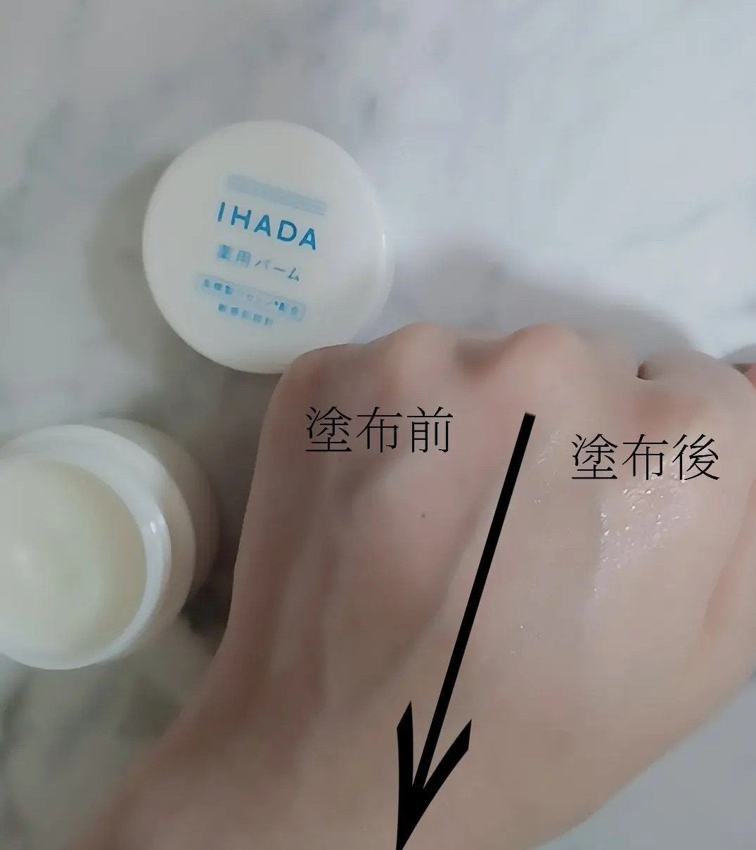 イハダ 薬用バーム【医薬部外品】/IHADA/フェイスバームを使ったクチコミ(2枚目)