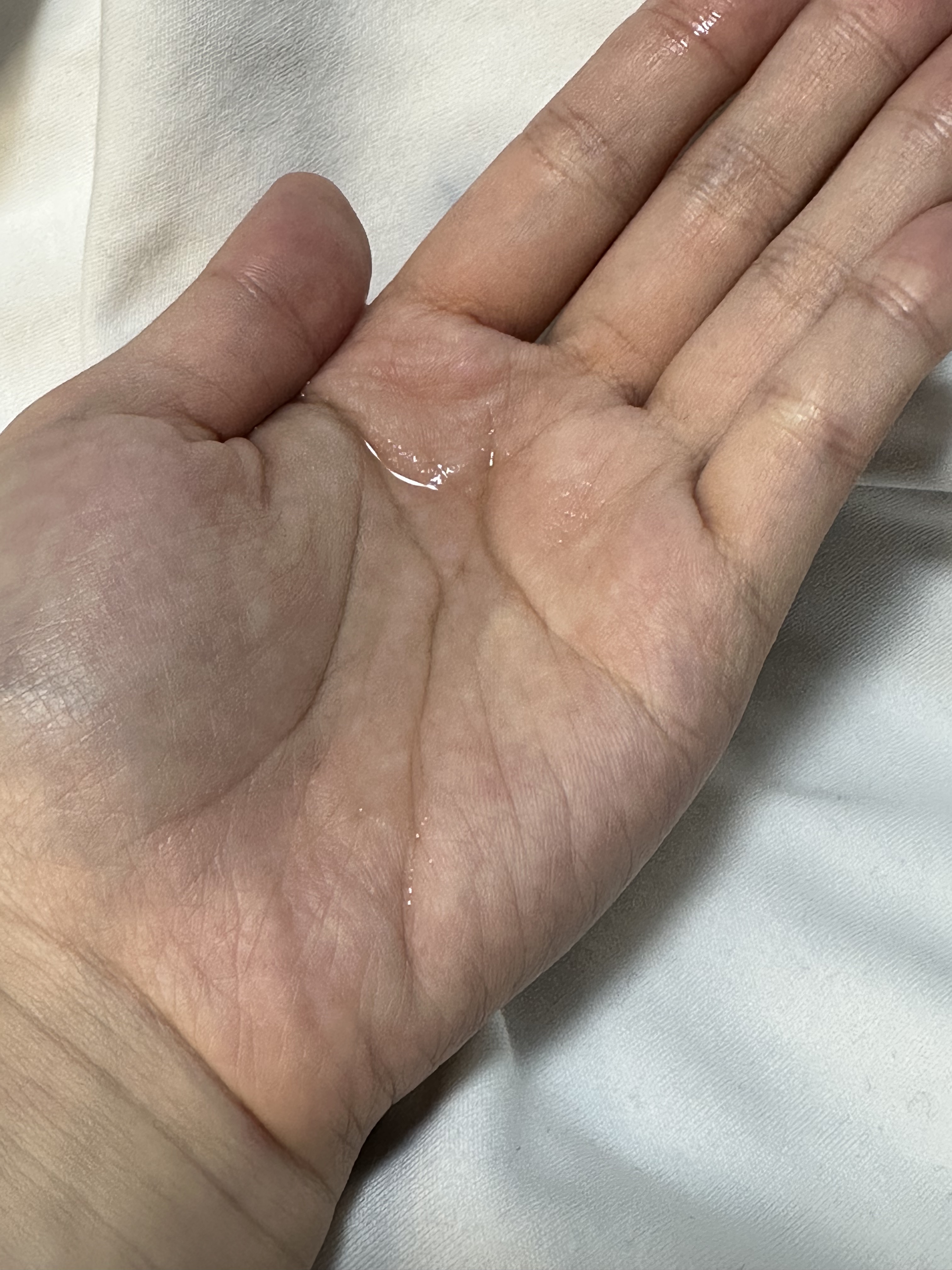 ピンクティーツリートナー/APLIN/化粧水を使ったクチコミ（2枚目）