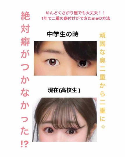 アイテープ(絆創膏タイプ、レギュラー、70枚)/DAISO/二重まぶた用アイテムを使ったクチコミ(1枚目)