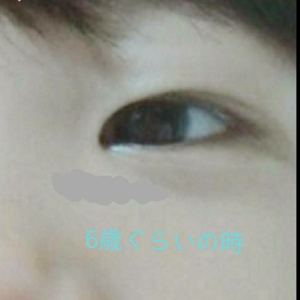 アイトーク/アイトーク/二重まぶた用アイテムを使ったクチコミ(2枚目)