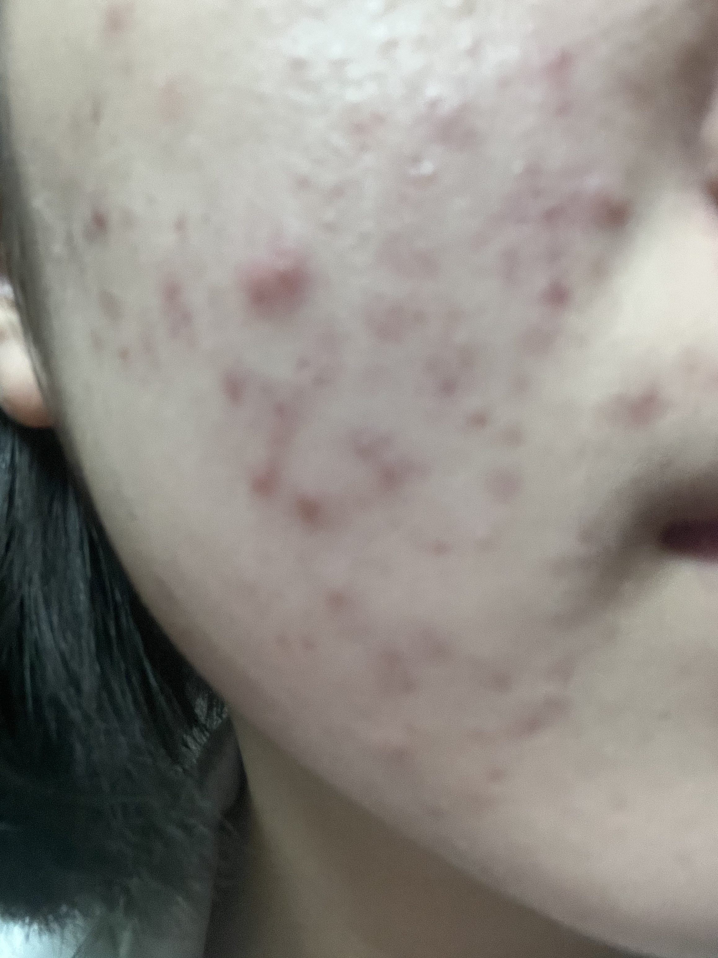 潤浸保湿 乳液/キュレル/乳液を使ったクチコミ（2枚目）