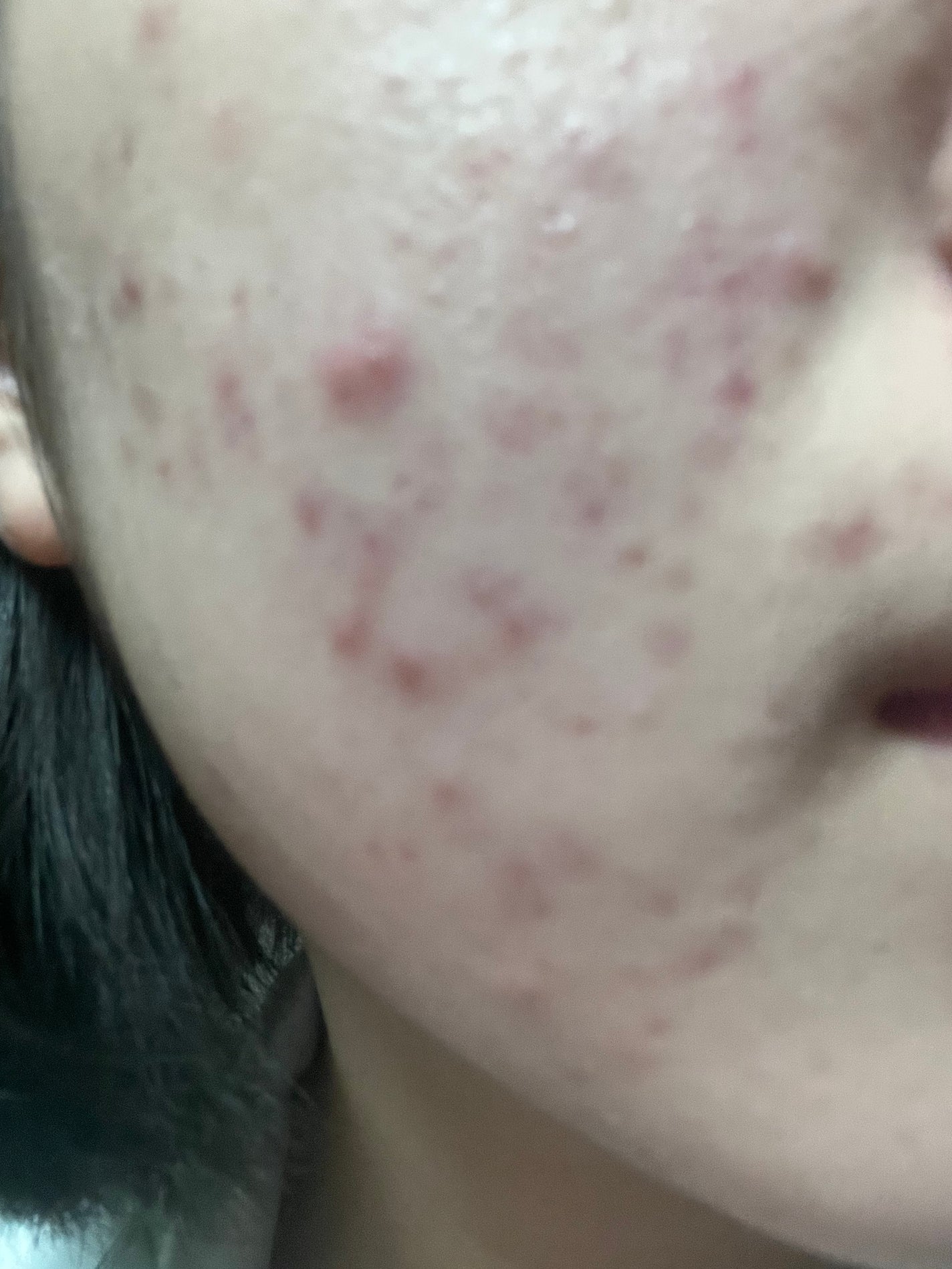 潤浸保湿 乳液/キュレル/乳液を使ったクチコミ(2枚目)