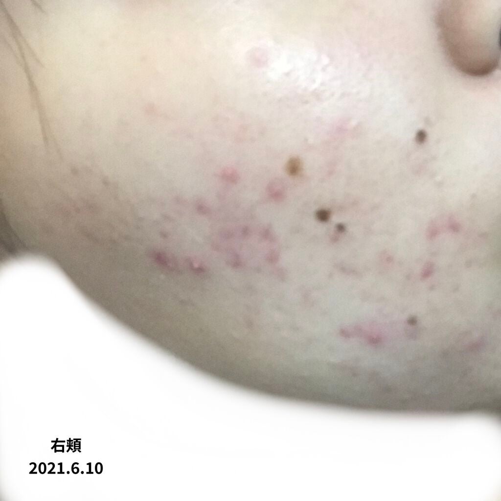 ããã¯ãªð°ðž on LIPS ã仿¥ãzoomææ¥é 匵ããŸããïŒãä»äºåŠæ ¡ãã®ä»è«žã
ã¿ãªããã..ãïŒ3æç®ïŒ