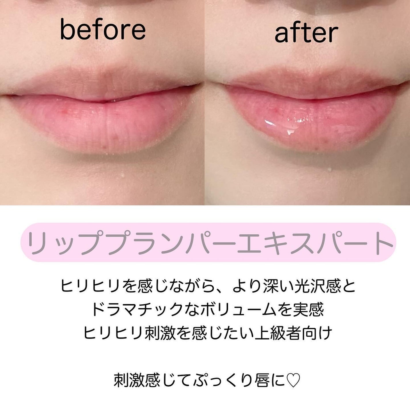 リードルS リッププランパービギナー/VT/リッププランパーを使ったクチコミ(6枚目)