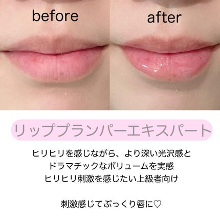 リードルS リッププランパービギナー/VT/リッププランパーを使ったクチコミ(6枚目)