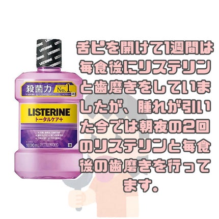 薬用リステリン トータルケア プラス/リステリン/マウスウォッシュ・スプレーを使ったクチコミ(2枚目)