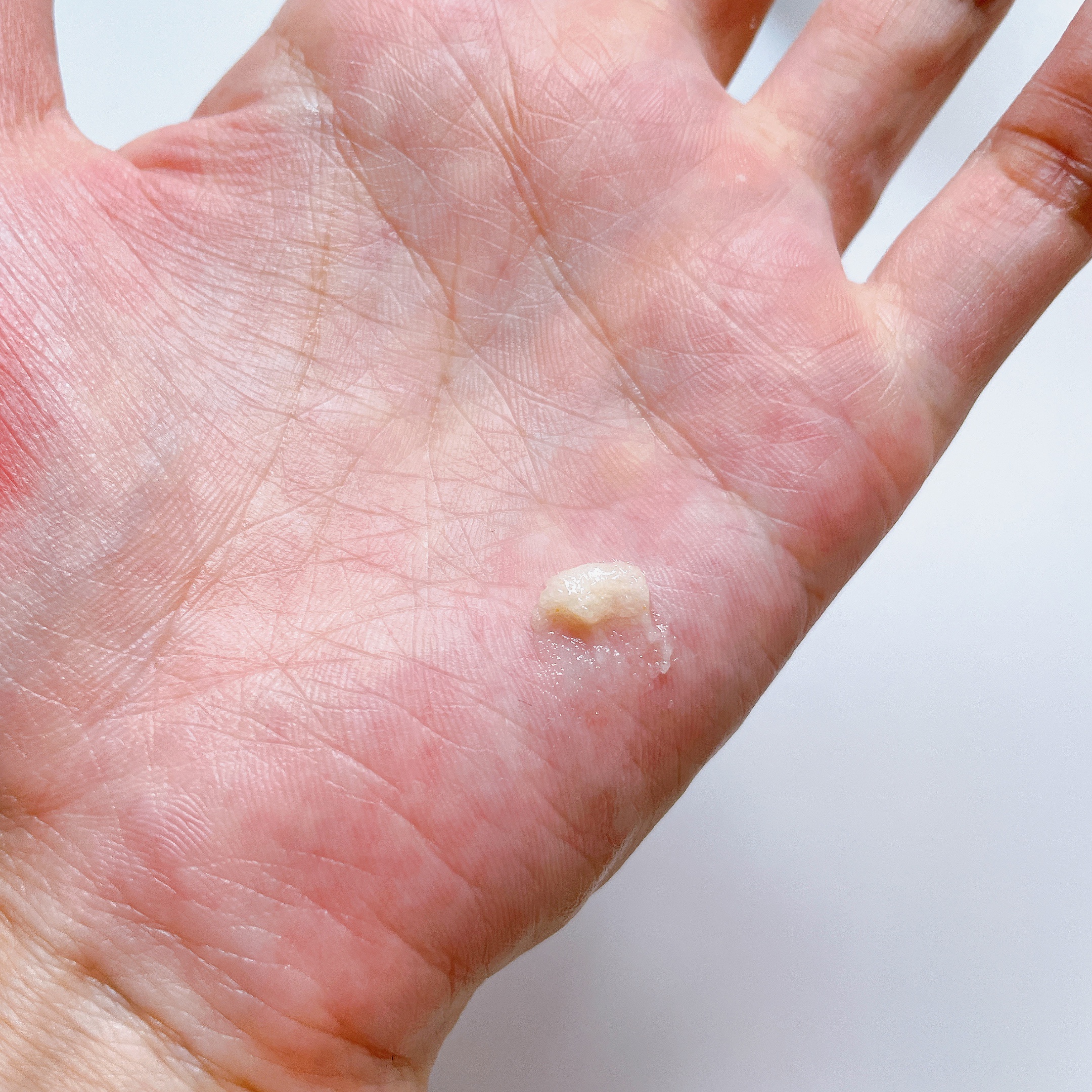 ポアセラメルティングスクラブセラム/MEDITHERAPY/美容液を使ったクチコミ（2枚目）