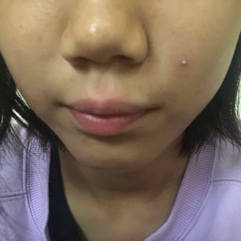 薬用洗顔フォーム しっかりタイプ/クレアラシル/洗顔フォームを使ったクチコミ（2枚目）