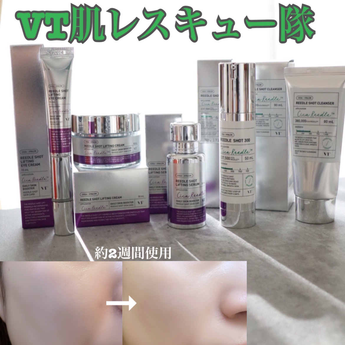 リードルショット リフティングセラム/VT/美容液を使ったクチコミ（1枚目）