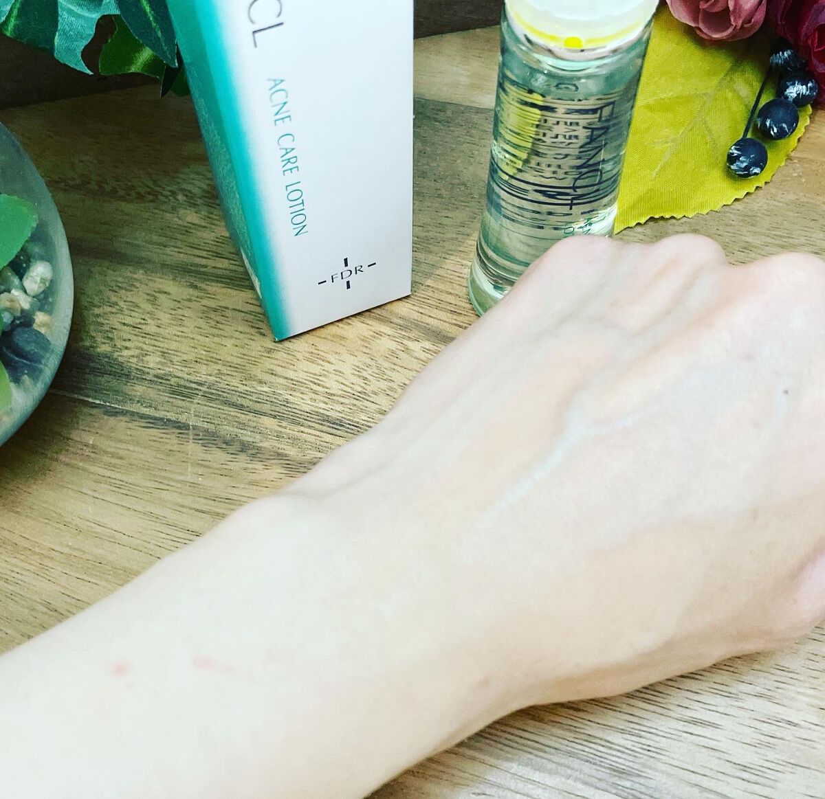 アクネケア 化粧液 <医薬部外品>/ファンケル/化粧水を使ったクチコミ(4枚目)