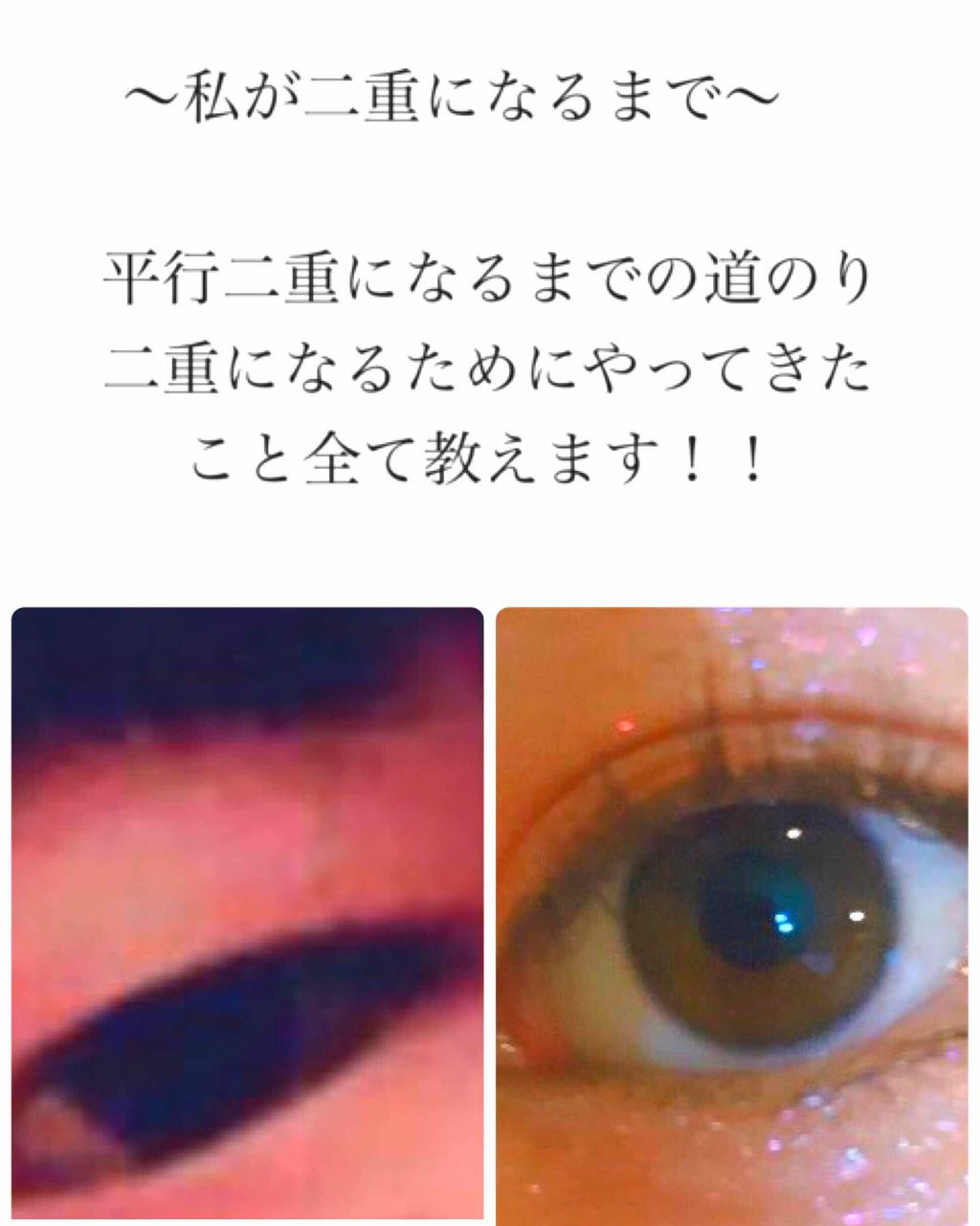 バイオリア アイテープ/エリザベス/二重まぶた用アイテムを使ったクチコミ(1枚目)