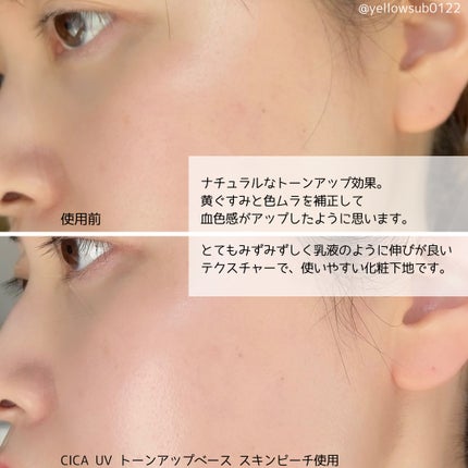 リードルショット100/VT/美容液を使ったクチコミ(5枚目)