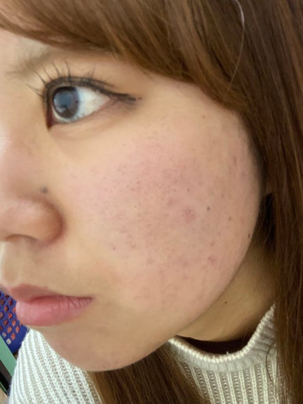 を使ったクチコミ(1枚目)