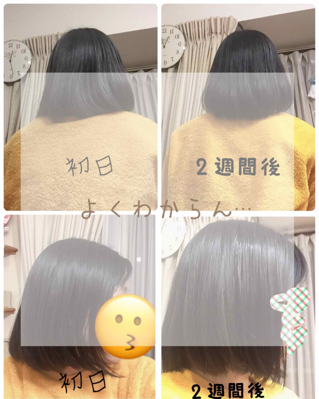 DHC 亜鉛/DHC/健康サプリメントを使ったクチコミ(2枚目)