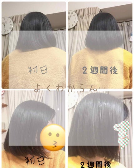 DHC 亜鉛/DHC/健康サプリメントを使ったクチコミ(2枚目)