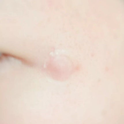 OK CICA CLEAR PATCH/GR/その他を使ったクチコミ(7枚目)