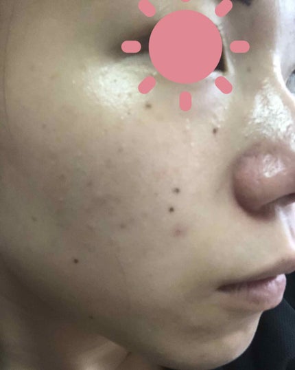 オバジC10セラム/オバジ/美容液を使ったクチコミ(2枚目)