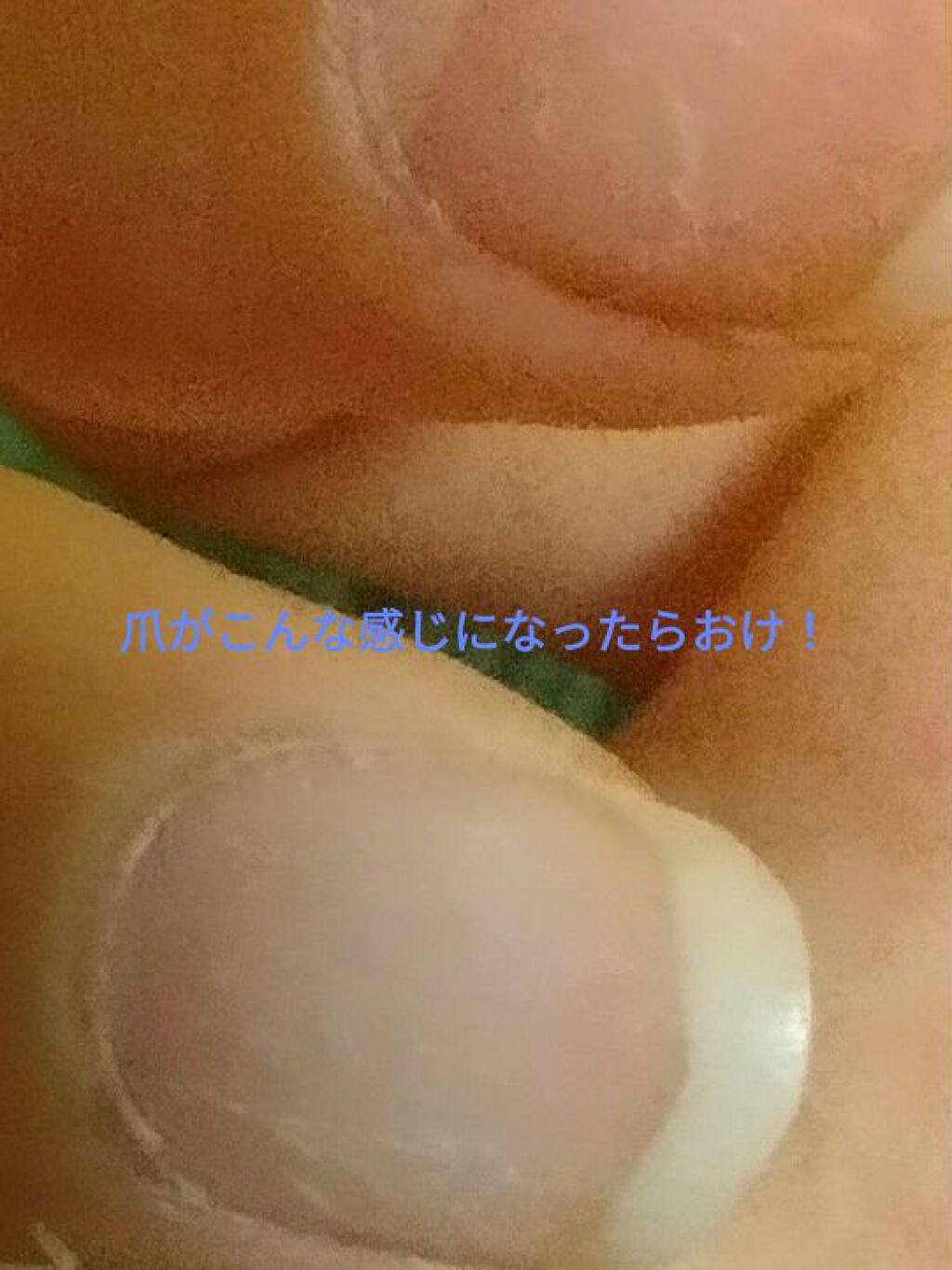 3ステップつめみがき/DAISO/ネイル用品を使ったクチコミ（3枚目）