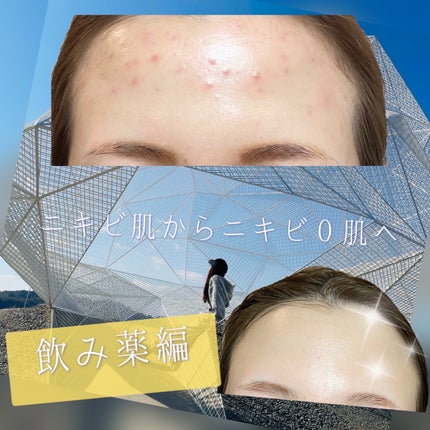 サンホワイトP-1/サンホワイト/ボディクリームを使ったクチコミ(1枚目)