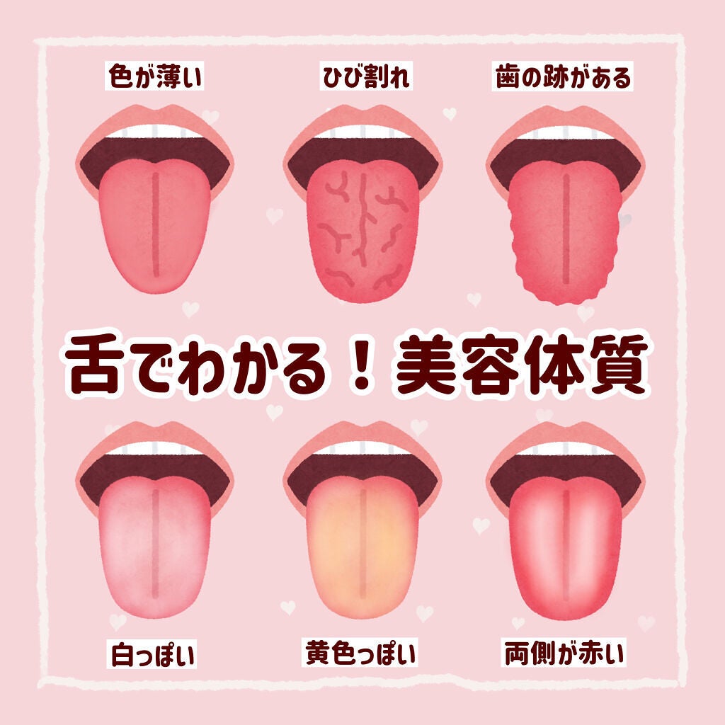 ソフト舌クリーナー 舌も ののじの口コミ 舌でわかる あなたの美容体質 By ぽん Lips ソフト舌クリーナー 舌も ののじの口コミ 舌でわかる あなたの美容体質 By ぽん Lips