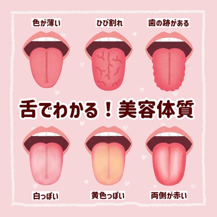 ソフト舌クリーナー 「舌も」/ののじ/歯ブラシを使ったクチコミ(1枚目)