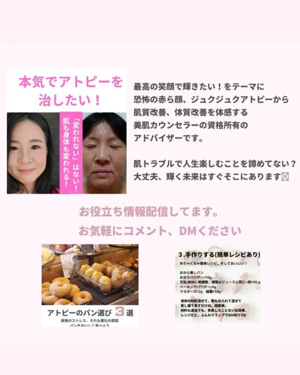 美肌カウンセラー💆肌悩みを解決し見る世界を変える on LIPS 「悩みだらけの頭皮トラブルだったのにいまは\美容師さんも驚く髪質..」(9枚目)