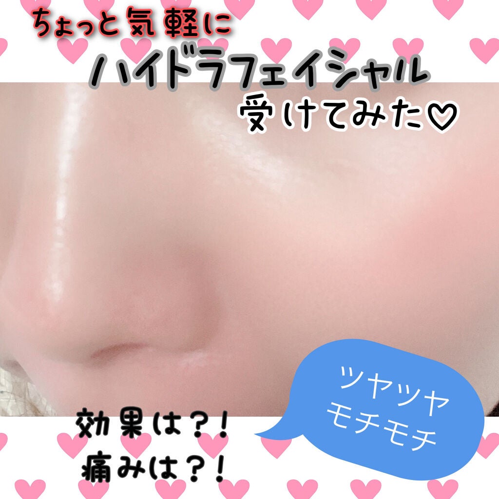 エンリッチプラス 化粧液Ⅱ しっとり <医薬部外品>/ファンケル/化粧水を使ったクチコミ(1枚目)