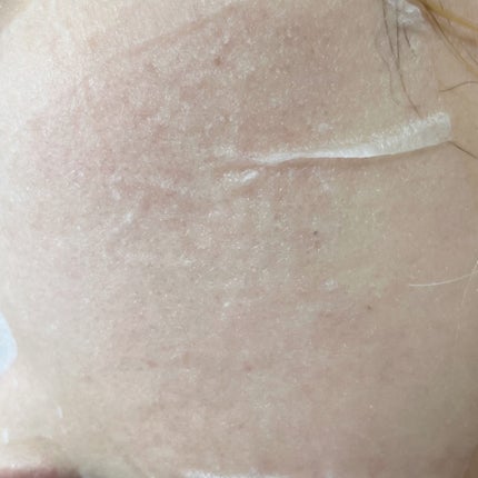 リードルショット100/VT/美容液を使ったクチコミ(8枚目)