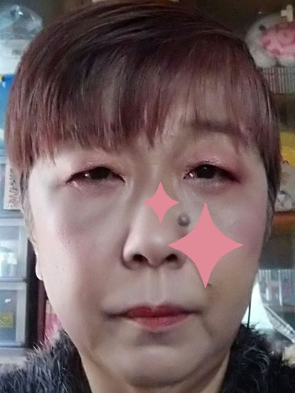 カバーパーフェクション アイディールコンシーラー デュオ/the SAEM/スティックコンシーラーを使ったクチコミ(3枚目)