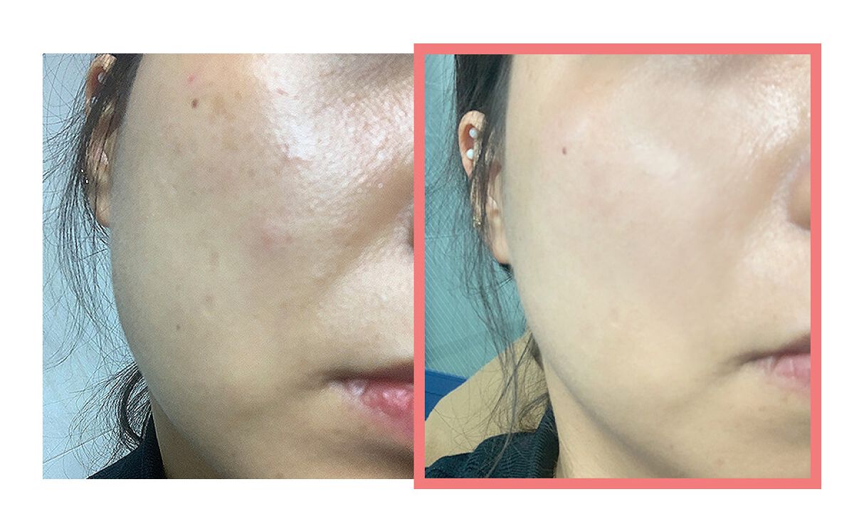 チェリーブロッサムブレミッシュ8GFクリーム/Bring Back/フェイスクリームを使ったクチコミ（2枚目）