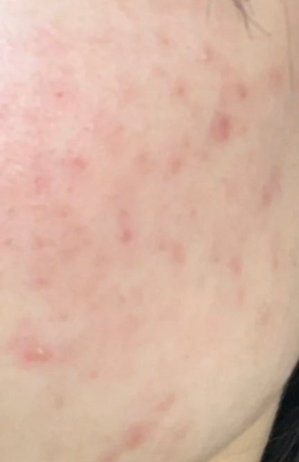 hinari on LIPS ãðã²ãšã€åã®æçš¿ã§ã®å¹æã«ã€ããŠã§ãâºïžðããããã²ã©ãã£ãæ..ãïŒ6æç®ïŒ