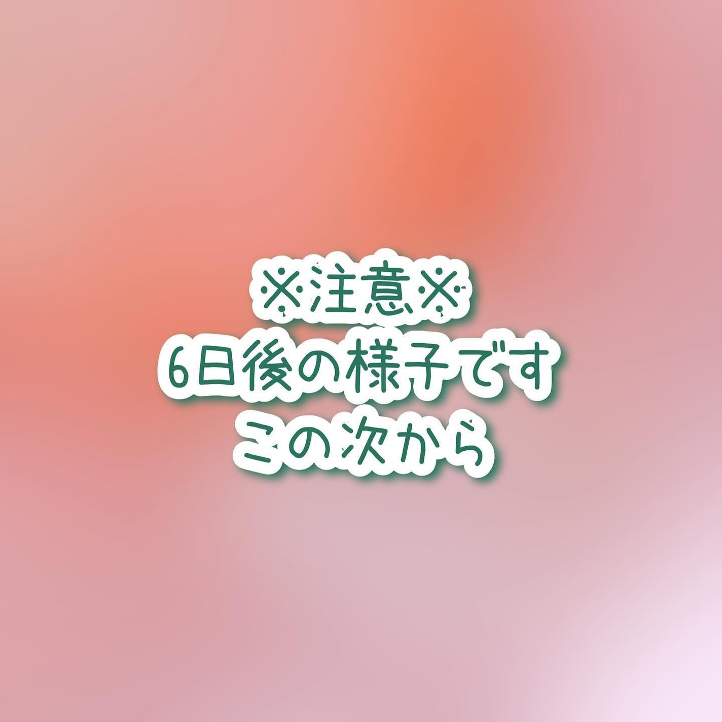 あしやすめ 足裏角質ケアパック/鎌倉ライフ/レッグ・フットケアを使ったクチコミ(5枚目)
