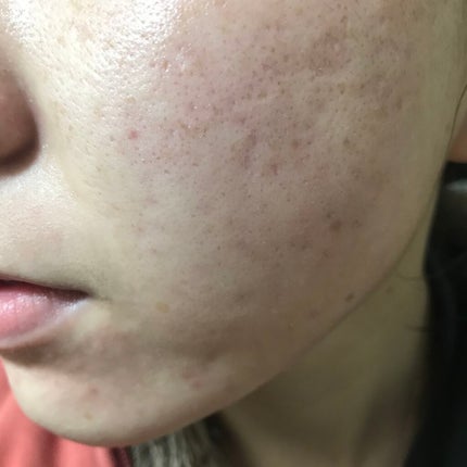 ライトリフレクティングセッティングパウダー プレスト N/NARS/プレストパウダーを使ったクチコミ(2枚目)