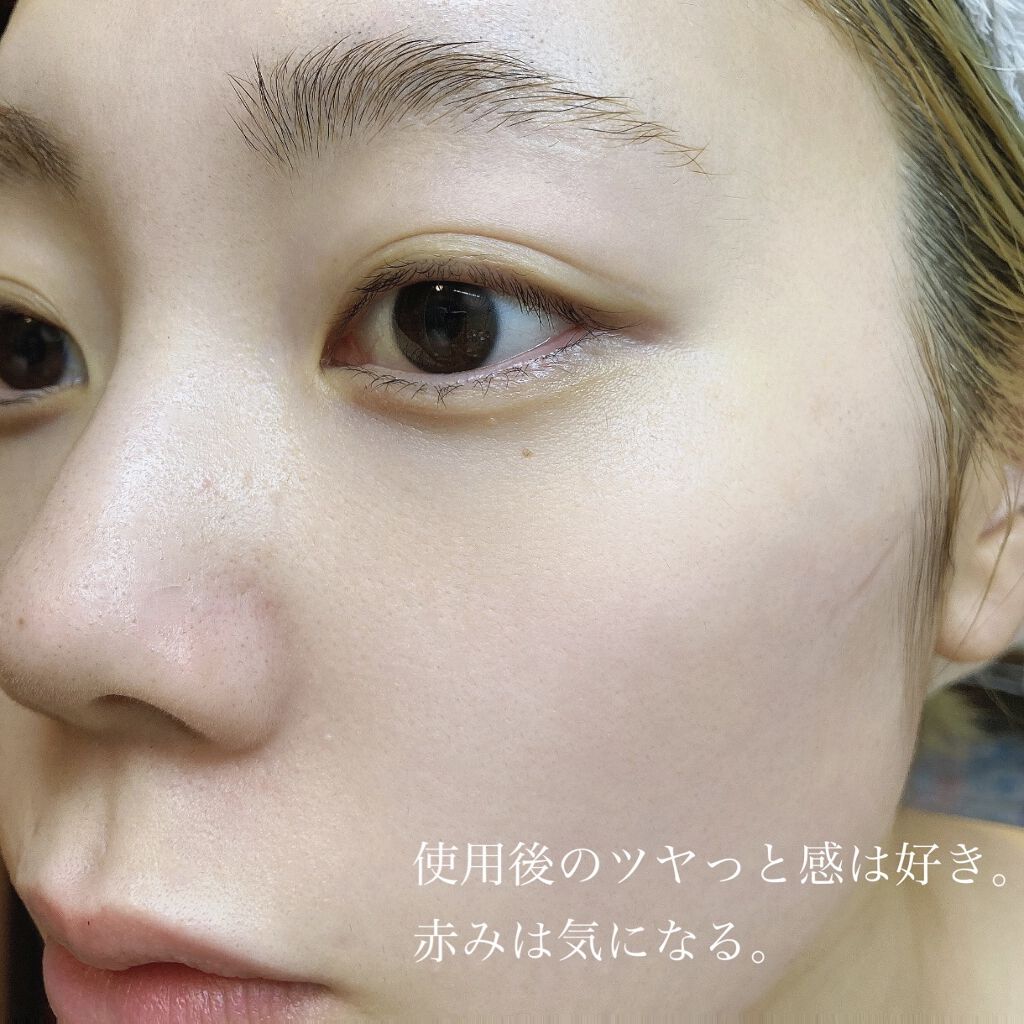 センテルカーミングショットアンプル/AMPLE:N/美容液を使ったクチコミ（3枚目）