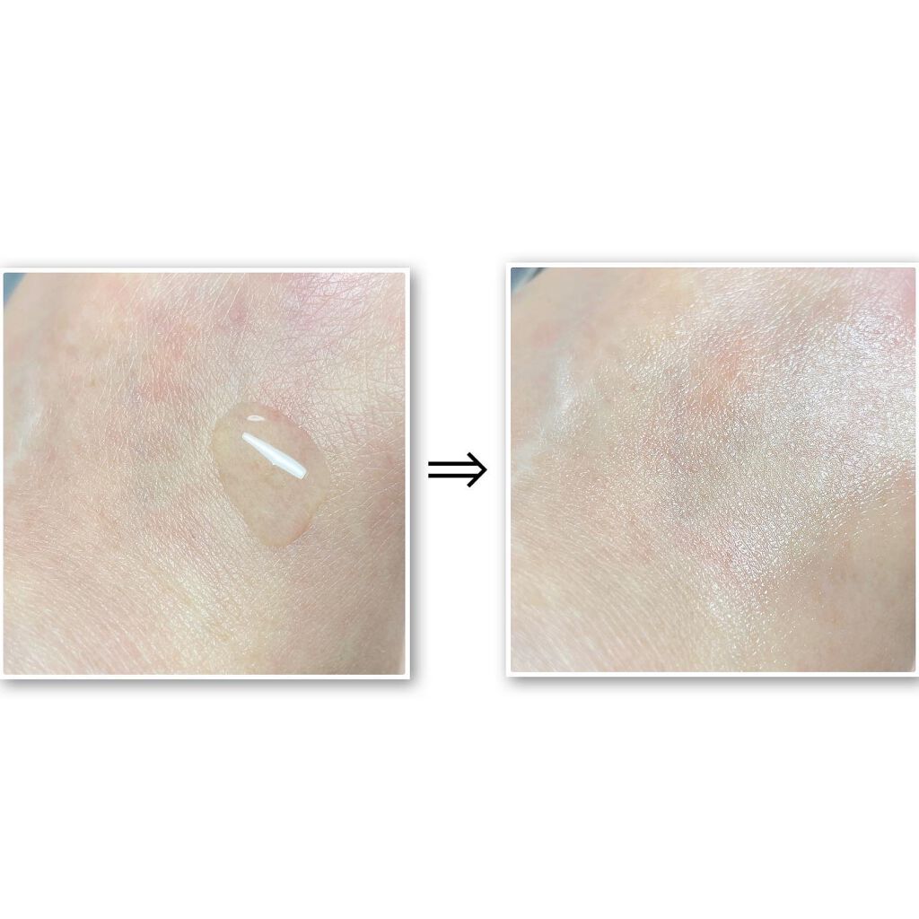 センテラカーミング アンプルトナー/バールコスメティックス/化粧水を使ったクチコミ(3枚目)