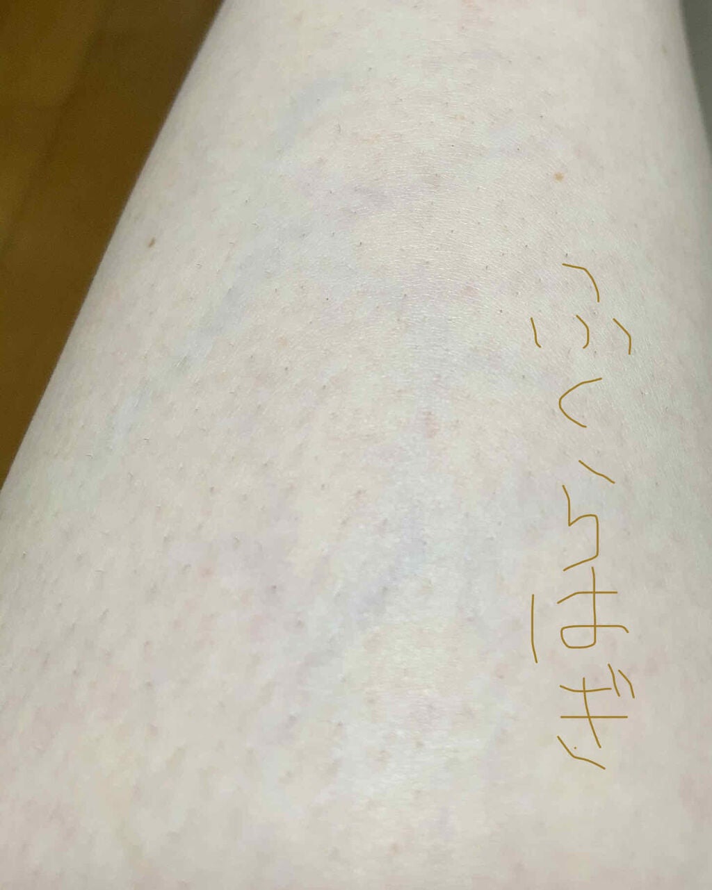 モイスチャライジングローション/セタフィル/ボディローションを使ったクチコミ(3枚目)