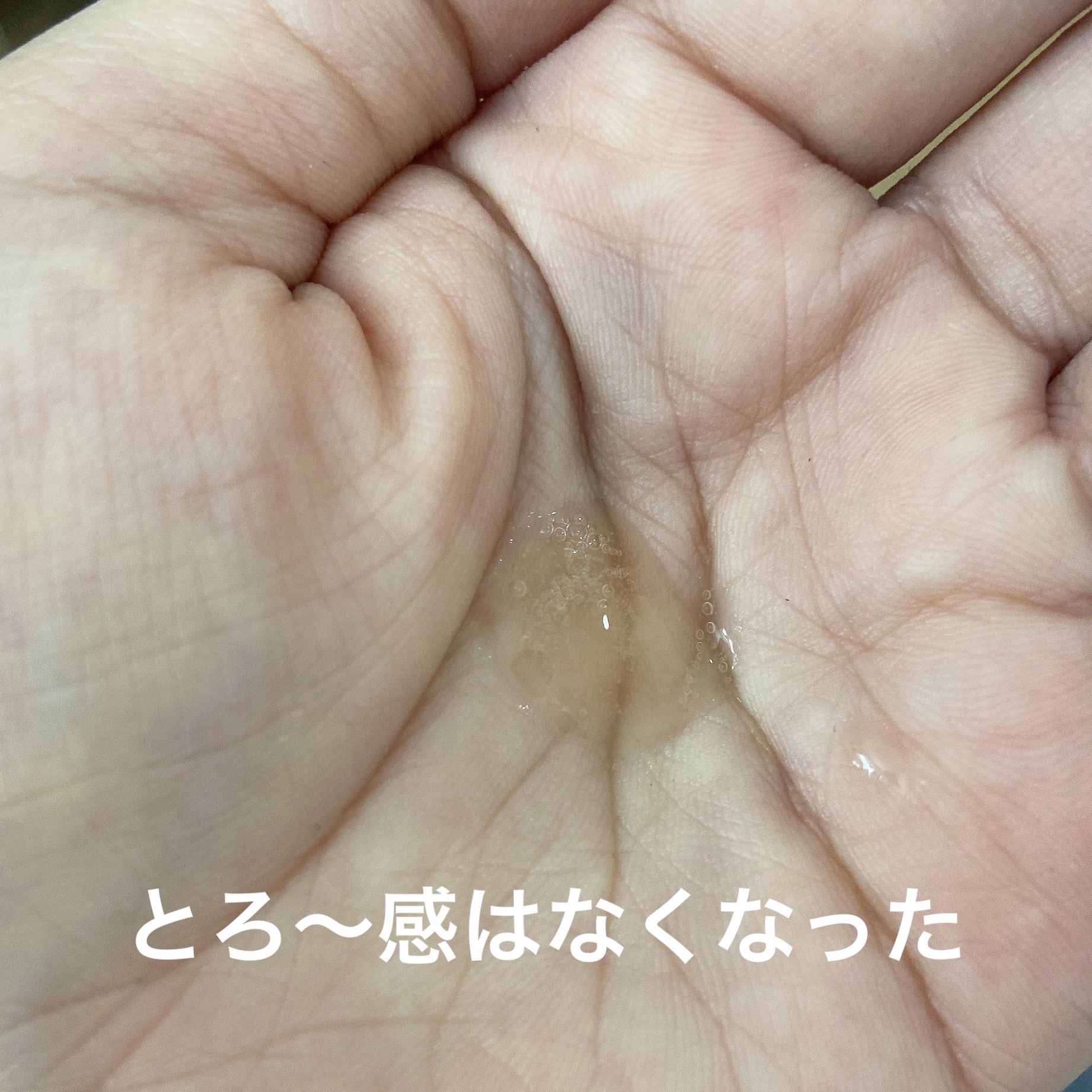 ビフィダバイオームコンプレックスセラム/manyo/美容液を使ったクチコミ（2枚目）