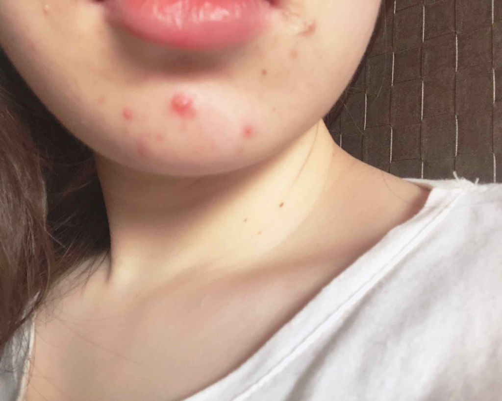 祐 佳 on LIPS 「1枚目からど汚い写真で目を汚してしまってすみません……。公害で..」(1枚目)