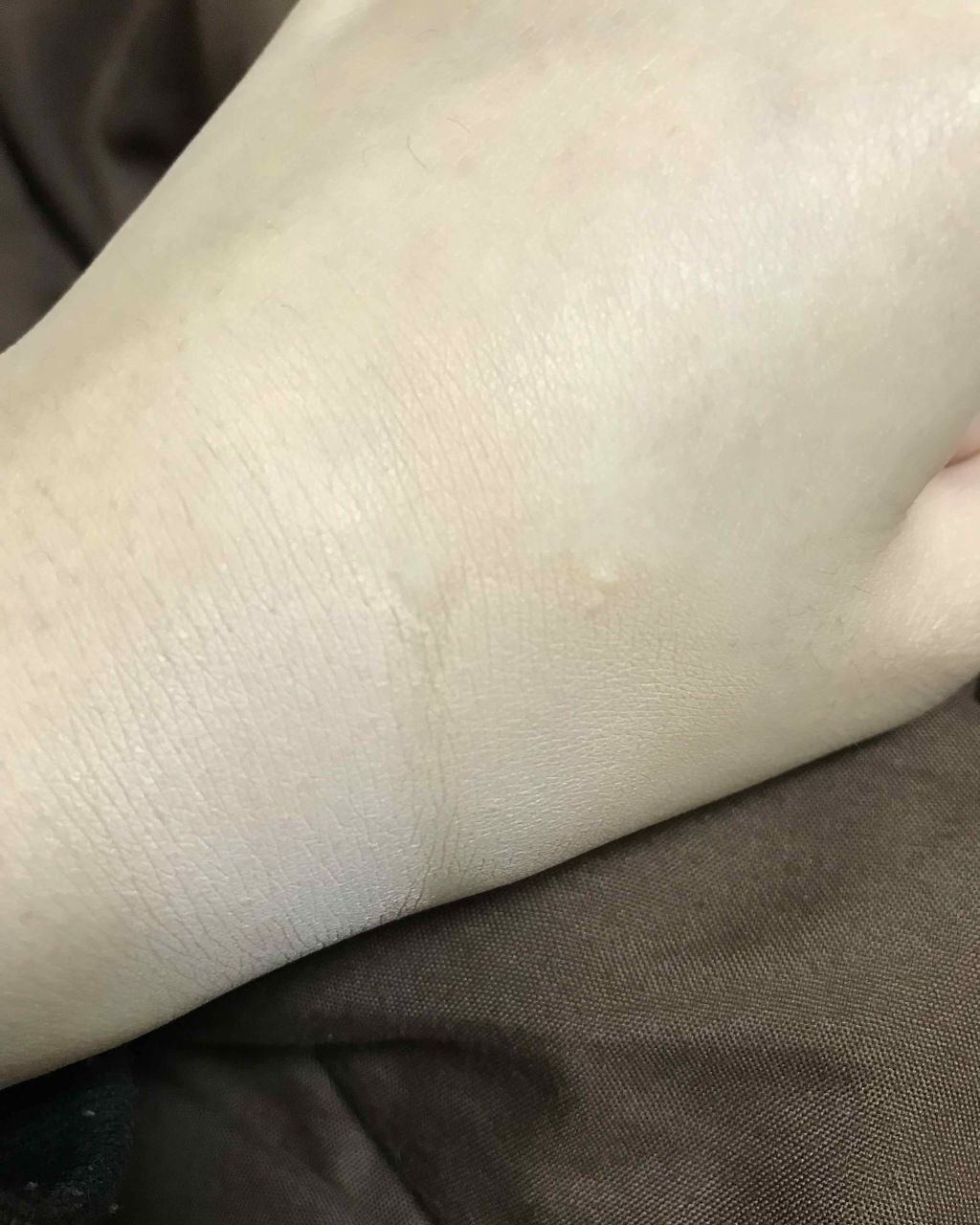 ハイカバーケアコンシーラー/CandyDoll/リキッドコンシーラーを使ったクチコミ(4枚目)