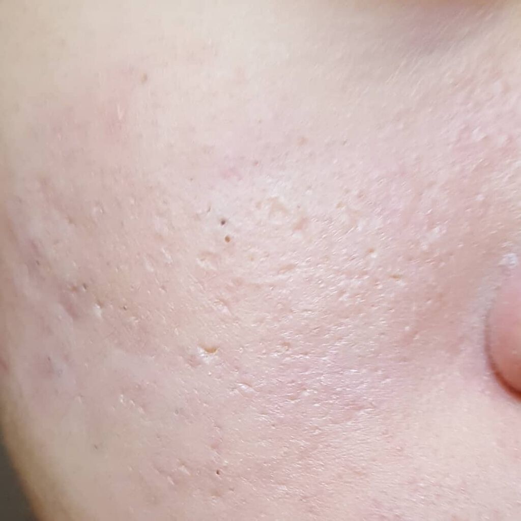 プレストパウダー C/ポイントマジックPRO/プレストパウダーを使ったクチコミ(4枚目)