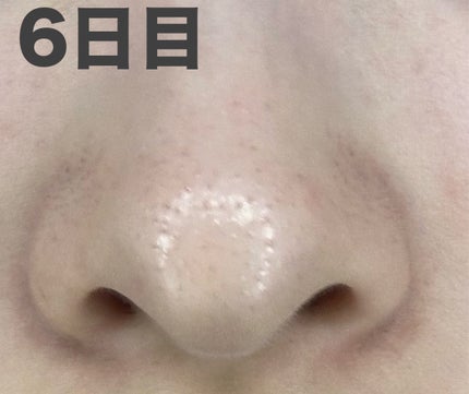 スキンコンディショナー高保湿/CEZANNE/化粧水を使ったクチコミ(5枚目)