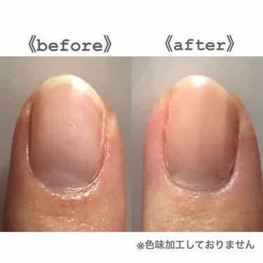 エナメル薄め液NA/SHISEIDO/ネイル用品を使ったクチコミ（2枚目）