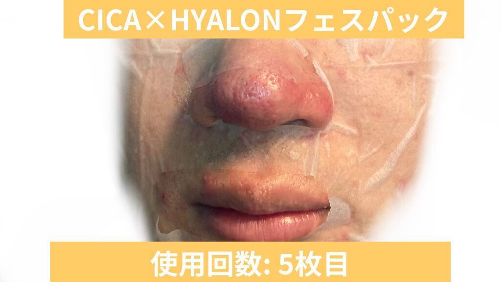 (フォロバ)3年後に韓国美男子 on LIPS 「CICA×HYALONフェスパック使用回数:5枚目潤う!2枚目..」(1枚目)