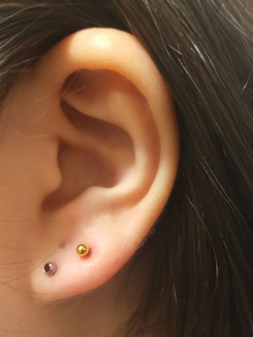 マキロンs (医薬品)/マキロン/その他を使ったクチコミ(5枚目)